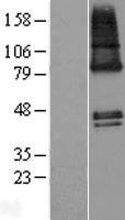 ls051114 zdhhc9 human over expression lysates nm 001008222 wb testing 2