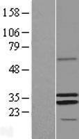 MRPS2 Human Over-expression Lysates NM_016034