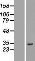 UTP11L (UTP11) Human Over-expression Lysates NM_016037