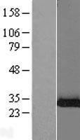 Shwachman Bodian Diamond syndrome (SBDS) Human Over-expression Lysates NM_016038
