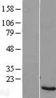 ZNF706 Human Over-expression Lysates NM_001042511