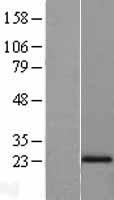 N acetyl transferase 5 (NAA20) Human Over-expression Lysates NM_016100