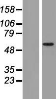 TRIM17 Human Over-expression Lysates NM_001024940