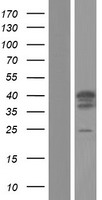 TRIM17 Human Over-expression Lysates NM_001134855