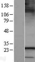 SAR1B Human Over-expression Lysates NM_016103