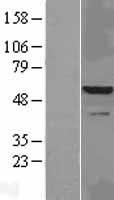IRAK4 Human Over-expression Lysates NM_001114182