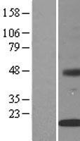 INSIG2 Human Over-expression Lysates NM_016133