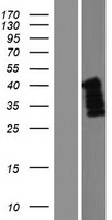 ls051149 c5orf45 mrnip human over expression lysates nm 001017987 wb testing 2