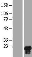 JPT1 Human Over-expression Lysates NM_016185