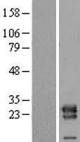 ls051160 vps28 human over expression lysates nm 183057 wb testing 2