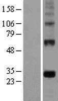 EGFL7 Human Over-expression Lysates NM_201446