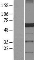 ls051164 dctn4 human over expression lysates nm 016221 wb testing 1