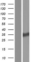 HSD17B11 Human Over-expression Lysates NM_016245
