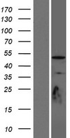 TUBD1 Human Over-expression Lysates NM_016261