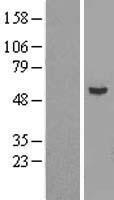 epsilon Tubulin (TUBE1) Human Over-expression Lysates NM_016262