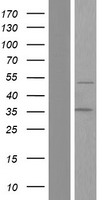LEF1 Human Over-expression Lysates NM_001130714