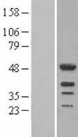 LEF1 Human Over-expression Lysates NM_016269