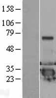DCXR Human Over-expression Lysates NM_016286