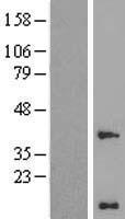 WBP5 (TCEAL9) Human Over-expression Lysates NM_001006612