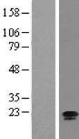 ls051187 c15orf15 rsl24d1 human over expression lysates nm 016304 wb testing 1