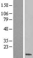 SS18L2 Human Over-expression Lysates NM_016305