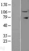 IPO11 Human Over-expression Lysates NM_016338