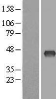 ZDHHC2 Human Over-expression Lysates NM_016353