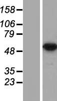 DDX47 Human Over-expression Lysates NM_016355