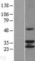 TACO1 Human Over-expression Lysates NM_016360