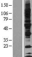 Glycoprotein VI (GP6) Human Over-expression Lysates NM_016363