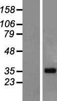 LUZP4 Human Over-expression Lysates NM_016383