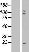 ls051234 tmem85 emc4 human over expression lysates nm 016454 wb testing 1