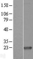 Proapoptotic Caspase Adaptor Protein (MZB1) Human Over-expression Lysates NM_016459