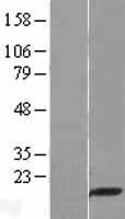 PDZD11 Human Over-expression Lysates NM_016484