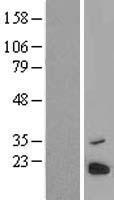 ls051250 mtres1 human over expression lysates nm 001142468 wb testing 2