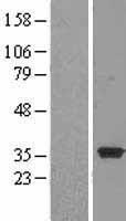 NT5C3 (NT5C3A) Human Over-expression Lysates NM_016489