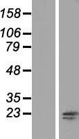 RNF181 Human Over-expression Lysates NM_016494