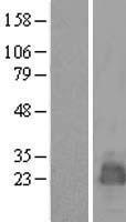 MARCHF2 Human Over-expression Lysates NM_001005415