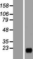 MARCHF2 Human Over-expression Lysates NM_001005416