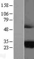 MARCHF2 Human Over-expression Lysates NM_016496