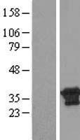 CXorf26 (PBDC1) Human Over-expression Lysates NM_016500