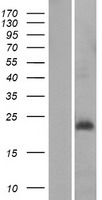 MRPL30 Human Over-expression Lysates NM_145212