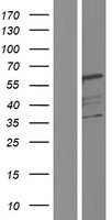 UBAP1 Human Over-expression Lysates NM_001171201