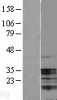 UBAP1 Human Over-expression Lysates NM_016525