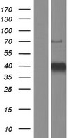 KLF3 Human Over-expression Lysates NM_016531