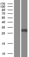 RBJ (DNAJC27) Human Over-expression Lysates NM_001198559