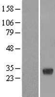RBJ (DNAJC27) Human Over-expression Lysates NM_016544