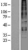 Relaxin 3 receptor 1 (RXFP3) Human Over-expression Lysates NM_016568