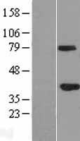 GMPR2 Human Over-expression Lysates NM_001002000