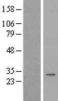 TIMMDC1 Human Over-expression Lysates NM_016589